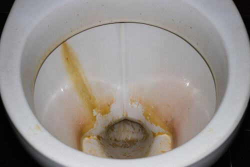 Calcium Buildup in Toilet: Why Does It Happen and How Can It Be Removed?